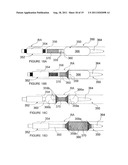 METHODS AND APPARATUS FOR PULSED ELECTRIC FIELD NEUROMODULATION VIA AN     INTRA-TO-EXTRAVASCULAR APPROACH diagram and image