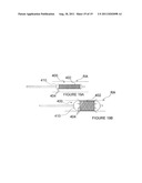 METHODS AND APPARATUS FOR PULSED ELECTRIC FIELD NEUROMODULATION VIA AN     INTRA-TO-EXTRAVASCULAR APPROACH diagram and image