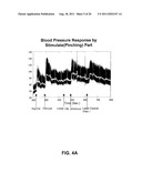 BLOOD PRESSURE STABILIZATION SYSTEM USING TRANSDERMAL STIMULATION diagram and image