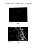 ARTIFICIAL STENT AND ITS PREPARATION METHOD diagram and image