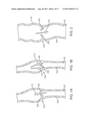 Apparatus and Methods for Creating a Venous Valve From Autologous Tissue diagram and image