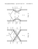 Apparatus and Methods for Creating a Venous Valve From Autologous Tissue diagram and image