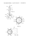 Apparatus and Methods for Creating a Venous Valve From Autologous Tissue diagram and image