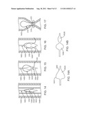 Apparatus and Methods for Creating a Venous Valve From Autologous Tissue diagram and image