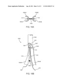 Apparatus and Methods for Creating a Venous Valve From Autologous Tissue diagram and image