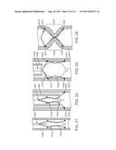 Apparatus and Methods for Creating a Venous Valve From Autologous Tissue diagram and image