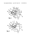 METHOD AND SYSTEM FOR LONG TERM ADJUSTMENT OF AN IMPLANTABLE DEVICE diagram and image