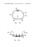 METHOD AND SYSTEM FOR LONG TERM ADJUSTMENT OF AN IMPLANTABLE DEVICE diagram and image