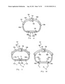 METHOD AND SYSTEM FOR LONG TERM ADJUSTMENT OF AN IMPLANTABLE DEVICE diagram and image