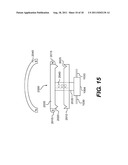 METHOD AND SYSTEM FOR LONG TERM ADJUSTMENT OF AN IMPLANTABLE DEVICE diagram and image