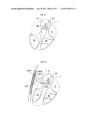 HEART HELP DEVICE, SYSTEM, AND METHOD diagram and image