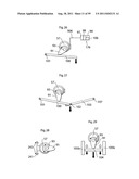 HEART HELP DEVICE, SYSTEM, AND METHOD diagram and image