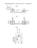 HEART HELP DEVICE, SYSTEM, AND METHOD diagram and image