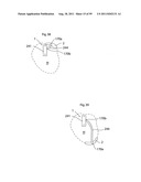 HEART HELP DEVICE, SYSTEM, AND METHOD diagram and image