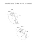 HEART HELP DEVICE, SYSTEM, AND METHOD diagram and image