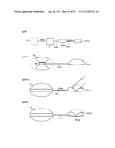 HEART HELP DEVICE, SYSTEM, AND METHOD diagram and image