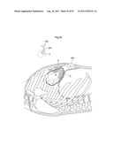 HEART HELP DEVICE, SYSTEM, AND METHOD diagram and image