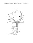 HEART HELP DEVICE, SYSTEM, AND METHOD diagram and image