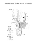 HEART HELP DEVICE, SYSTEM, AND METHOD diagram and image