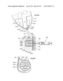 HEART HELP DEVICE, SYSTEM, AND METHOD diagram and image