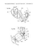 HEART HELP DEVICE, SYSTEM, AND METHOD diagram and image