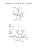 HEART HELP DEVICE, SYSTEM, AND METHOD diagram and image