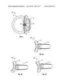 ARTICULATING SPINAL IMPLANT diagram and image