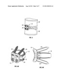 ARTICULATING SPINAL IMPLANT diagram and image