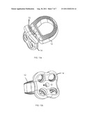 ARTICULATING SPINAL IMPLANT diagram and image