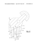 METHOD AND APPARATUS FOR AUGMENTING BONE DEFECTS diagram and image