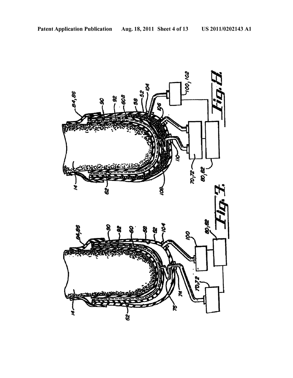 SOCKET LINER FOR ARTIFICIAL LIMB - diagram, schematic, and image 05