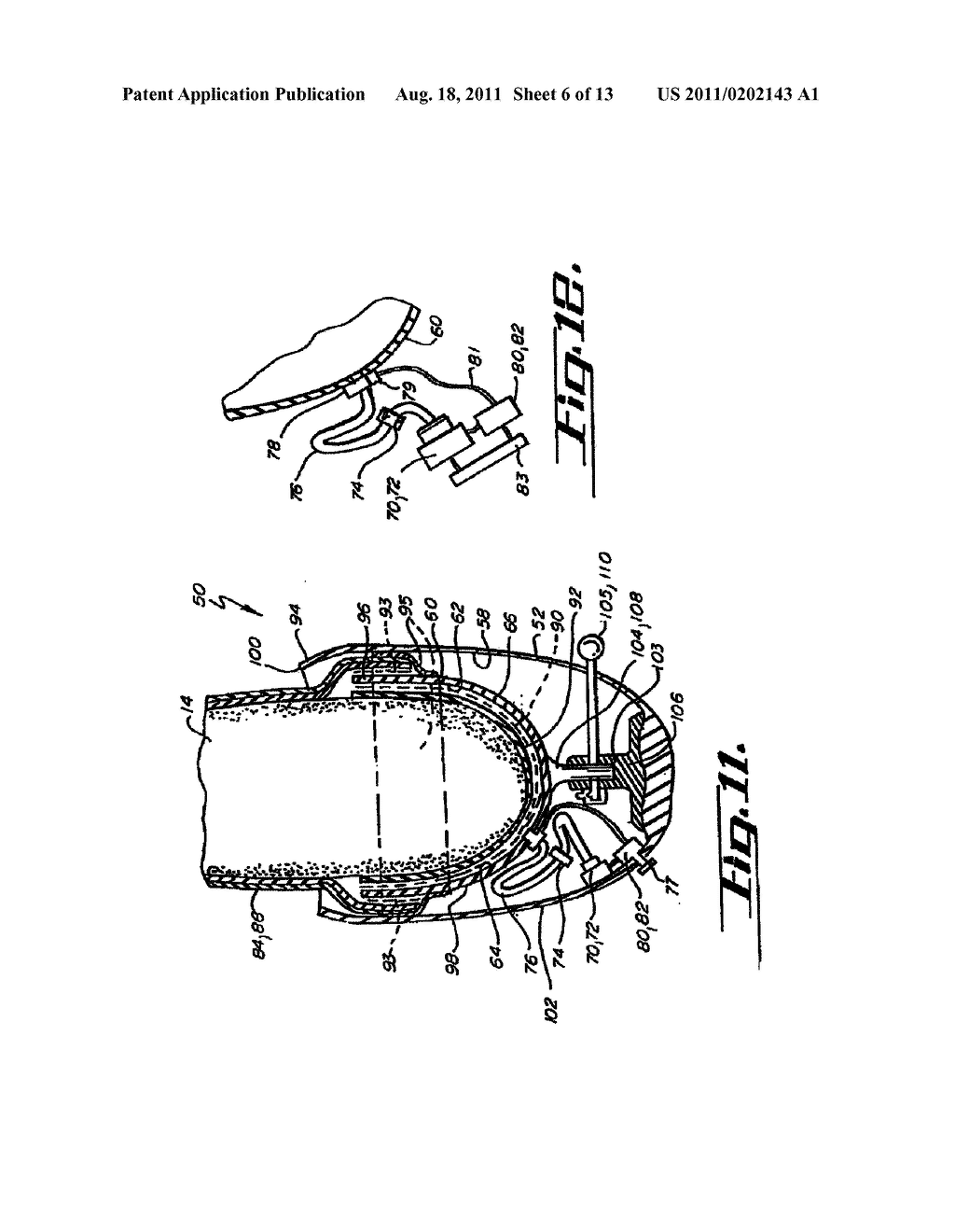 SOCKET LINER FOR ARTIFICIAL LIMB - diagram, schematic, and image 07