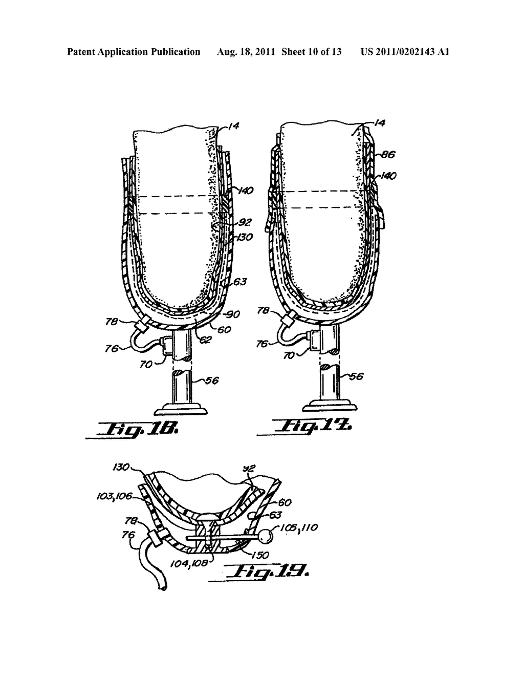 SOCKET LINER FOR ARTIFICIAL LIMB - diagram, schematic, and image 11