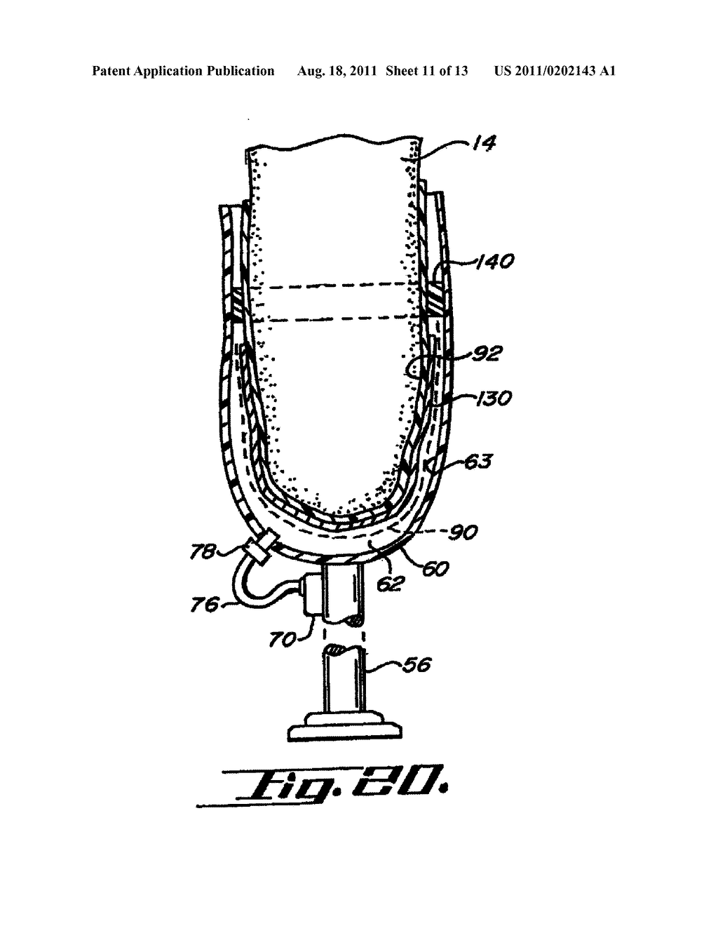 SOCKET LINER FOR ARTIFICIAL LIMB - diagram, schematic, and image 12