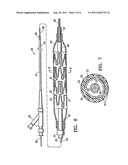 METHOD FOR RETAINING A VASCULAR STENT ON A CATHETER diagram and image