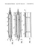 METHOD FOR RETAINING A VASCULAR STENT ON A CATHETER diagram and image