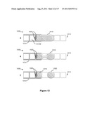 Bead Incubation and Washing on a Droplet Actuator diagram and image