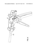 Laproscopic Stapler diagram and image