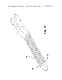 Laproscopic Stapler diagram and image