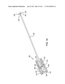 Laproscopic Stapler diagram and image