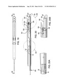 Laproscopic Stapler diagram and image