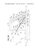 PRODUCT SERVER WITH BREATH GUARD diagram and image