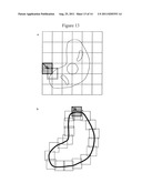 METHOD FOR OBSERVING SAMPLE AND ELECTRONIC MICROSCOPE diagram and image