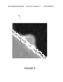 SYSTEMS, COMPUTER-READABLE MEDIA, AND METHODS FOR THE CLASSIFICATION OF     ANOMALIES IN VIRTUAL COLONOGRAPHY MEDICAL IMAGE PROCESSING diagram and image