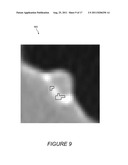 SYSTEMS, COMPUTER-READABLE MEDIA, AND METHODS FOR THE CLASSIFICATION OF     ANOMALIES IN VIRTUAL COLONOGRAPHY MEDICAL IMAGE PROCESSING diagram and image