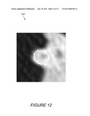 SYSTEMS, COMPUTER-READABLE MEDIA, AND METHODS FOR THE CLASSIFICATION OF     ANOMALIES IN VIRTUAL COLONOGRAPHY MEDICAL IMAGE PROCESSING diagram and image