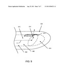 METHODS AND APPARATUS RELATED TO A SIDE-FIRE OPTICAL FIBER HAVING A ROBUST     DISTAL END PORTION diagram and image