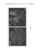 Therapeutic Compositions for the Treatment of Dry Eye Disease diagram and image