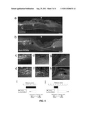 AXON REGENERATION PROMOTER diagram and image