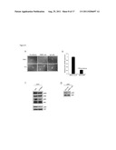 SPINK1 TARGETED THERAPY diagram and image